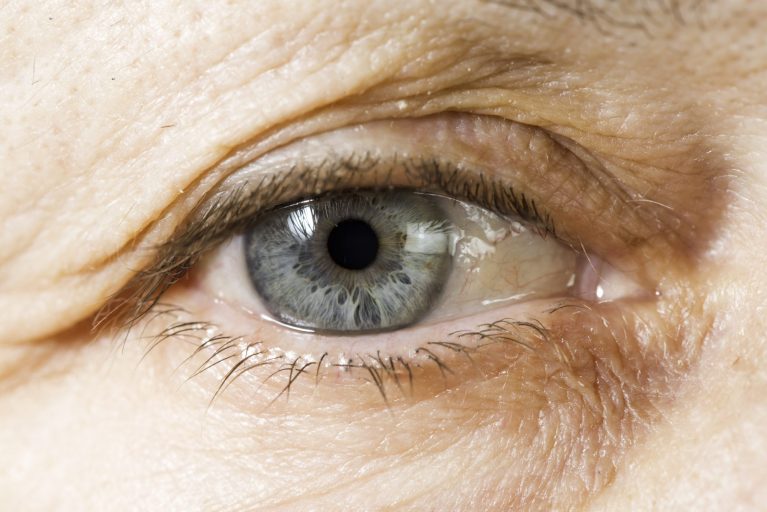 Glaucoma, la ceguera silenciosa.