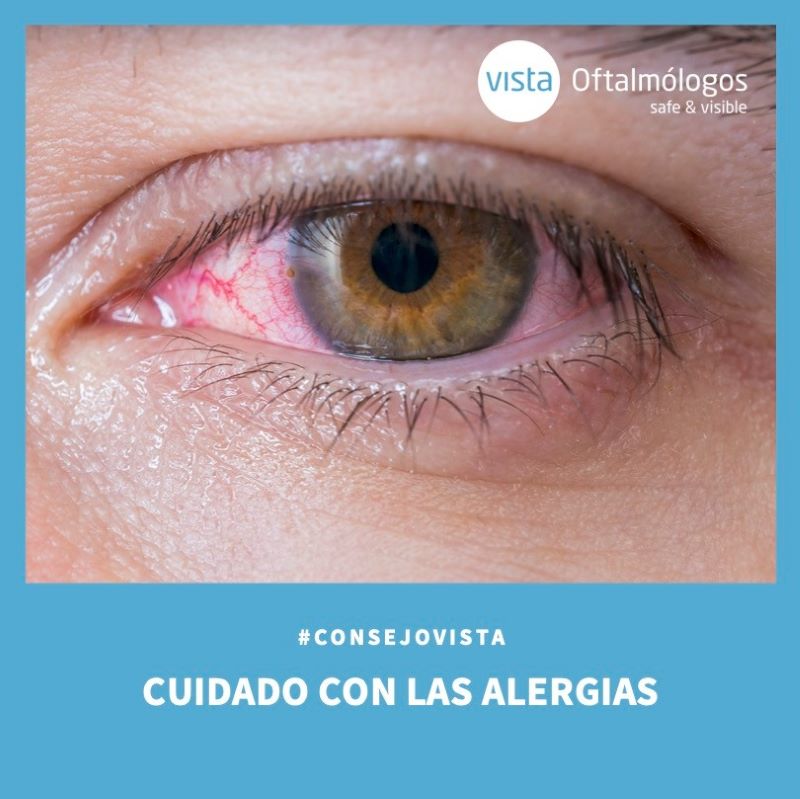 Otoño: Alergias oculares.