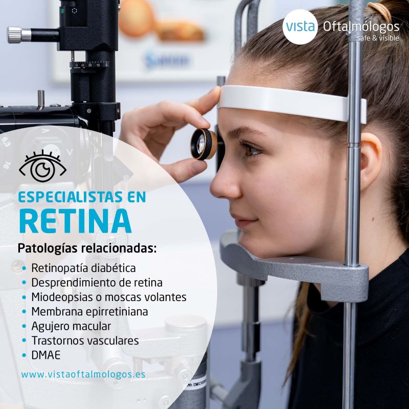 Especialistas en retina