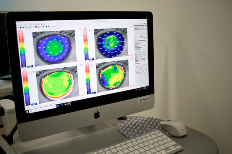 Estudio de astigmatismo