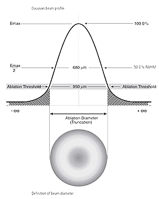 Ilustración sobre cirugía refractiva