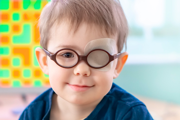 Niño pequeño con un parche en el ojo vago