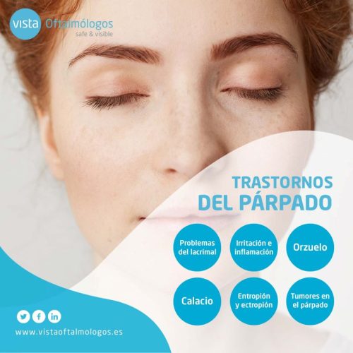 parpados def